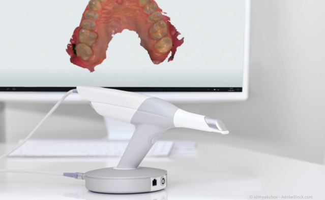 3D-Scanner: Digitale Abformung